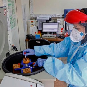 PEOPLE : Coronavirus  Quel est le groupe sanguin le plus touché par le virus ?