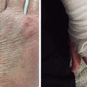 Les soignants montrent ce qu’ils vivent : épuisés et avec les mains ravagées par le gel hydroalcoolique