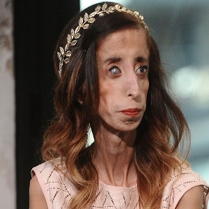 INSOLITE : La femme la plus laide du monde prend sa revanche