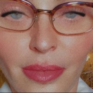 PEOPLE "Qu'as-tu fait à ton visage ?" : Madonna, méconnaissable, inquiète ses fans (PHOTOS)