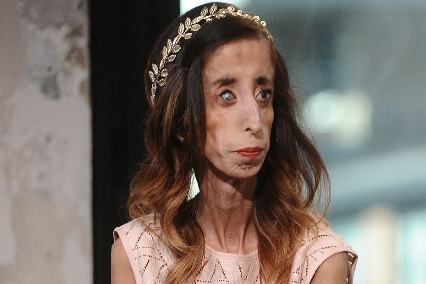 INSOLITE : La femme la plus laide du monde prend sa revanche