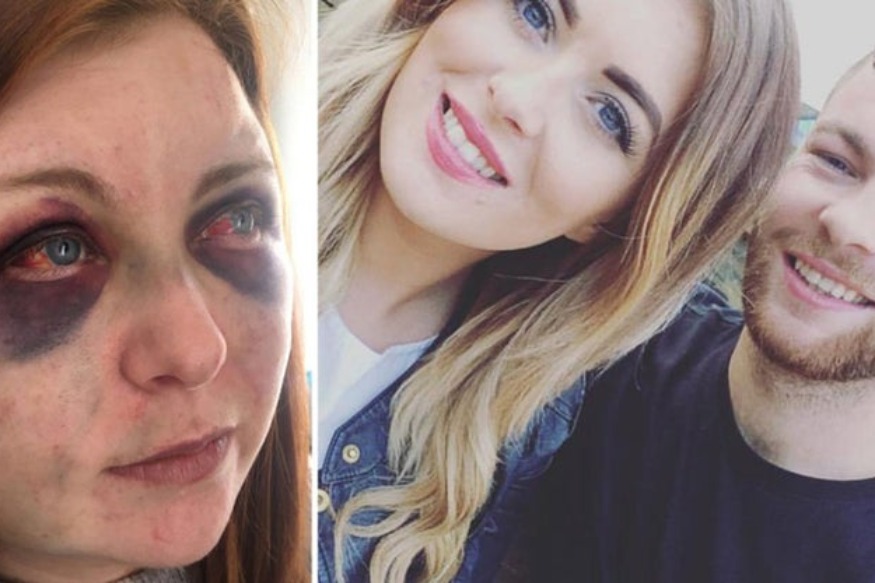 INSOLITE: Mon petit ami a essayé de m’arracher les yeux pour «que je sois si moche que personne ne veuille de moi»