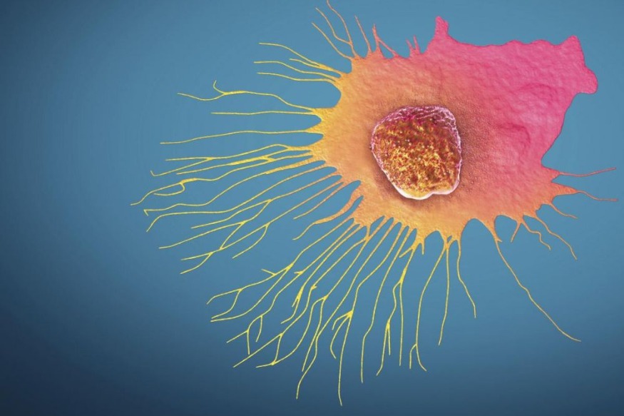 SANTE : Les symptômes du cancer que vous ignorez probablement